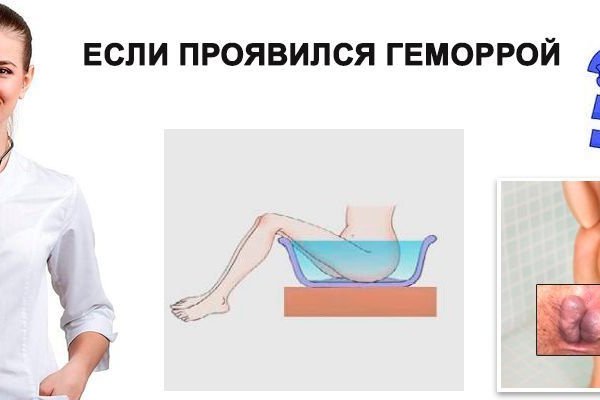 Сайты с наркотой